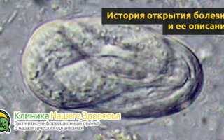 Болезнь стронгилоидоз, диагностика и лечение