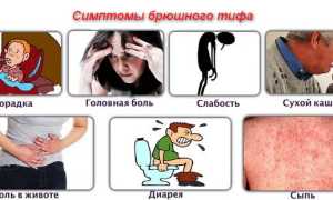 Как проводится дифференциальная диагностика брюшного тифа