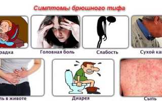 Как проводится дифференциальная диагностика брюшного тифа