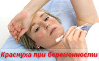 Краснуха у взрослых, симптомы и лечение