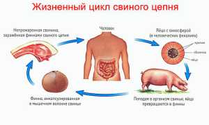 Свиной цепень – представитель ленточных гельминтов