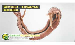 Церкариоз или «зуд купальщика» — симптомы и лечение