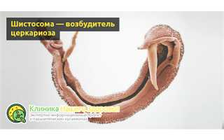 Церкариоз или «зуд купальщика» — симптомы и лечение