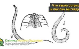Острицы у взрослых — симптоматика и избавление