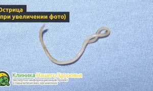Маленькие белые глисты в организме человека