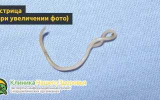 Маленькие белые глисты в организме человека