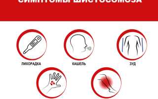 Шистосомоз — симптомы, лечение и диагностика заболевания