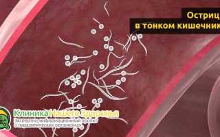 Лучшие препараты от остриц