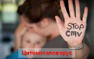 Цитомегаловирусная инфекция поражает каждого пятого ребенка