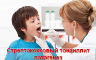 Сезонное воспалительное заболевание стрептококковый тонзиллит — симптомы и лечение