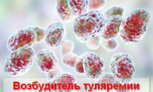 Бактериальное заболевание туляремия