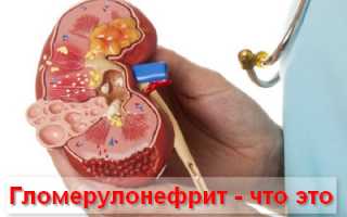 Гломерулонефрит, симптомы и лечение