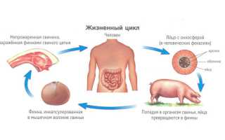 Тениоз: симптомы, диагностика, лечение и профилактика заболевания