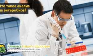 Анализ на энтеробиоз: как сдавать и подготовиться