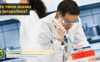 Анализ на энтеробиоз: как сдавать и подготовиться