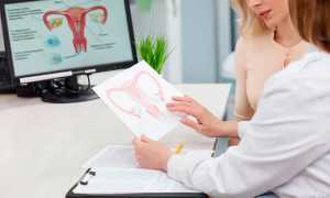 Почему возникает candida albicans у женщин и как от нее избавиться?