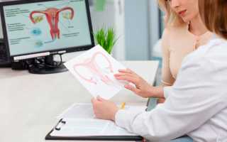 Почему возникает candida albicans у женщин и как от нее избавиться?