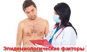 Что такое опоясывающий герпес, симптомы и лечение