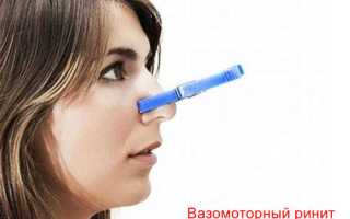 Постоянно заложен нос? Возможно, это вазомоторный ринит