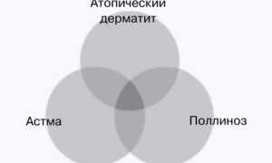Атопическая экзема — расшифровка загадочной сыпи на коже