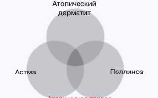 Атопическая экзема — расшифровка загадочной сыпи на коже