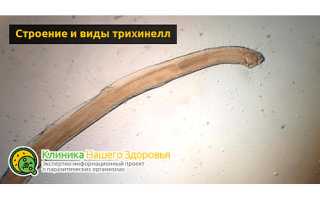 Трихинелла — жизненный цикл паразита
