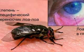 Лоаоз – симптомы и лечение гельминтоза