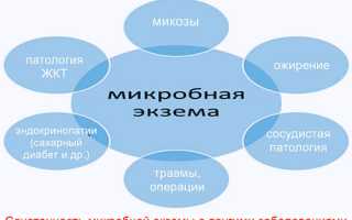 Микробная экзема — растущая проблема в современном мире