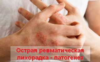 Чем опасна острая ревматическая лихорадка, причины и лечение