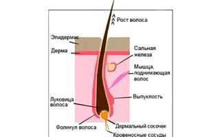Очаговая алопеция у женщин – волосы следует беречь