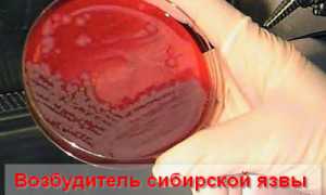 Почему сибирская язва требует обязательного карантина