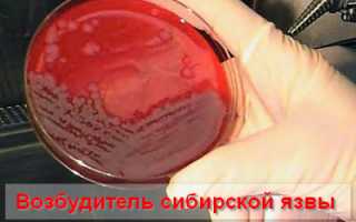 Почему сибирская язва требует обязательного карантина