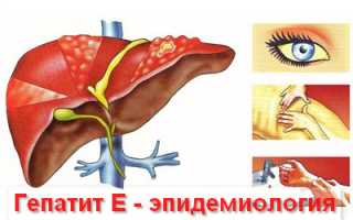 Гепатит Е и его место среди всех видов гепатитов