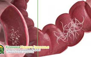 Народные средства для избавления от остриц