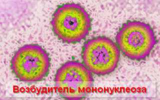 Чем и для кого опасен инфекционный мононуклеоз