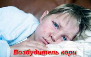 Корь — симптомы и лечение