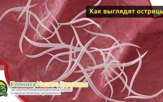 Как избавиться от остриц в домашних условиях