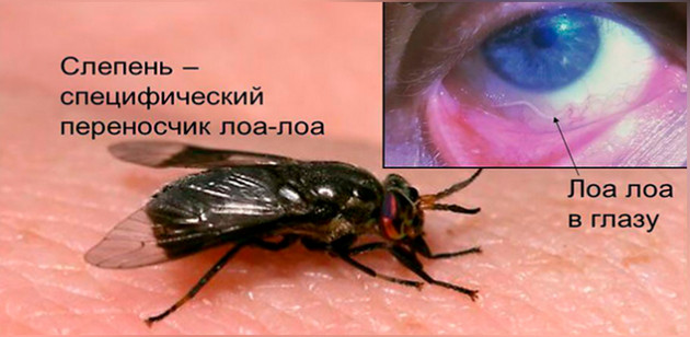 лоаоз возбудитель