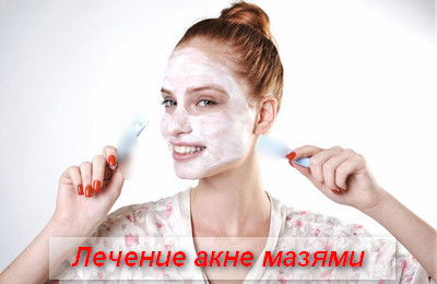 лечение акне мазями