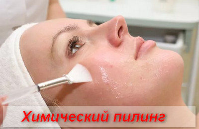 химический пилинг