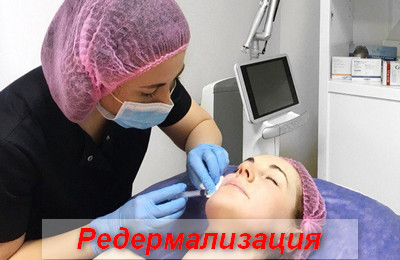 редермализация