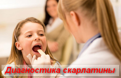 диагностика скарлатины