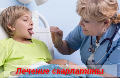 лечение скарлатины