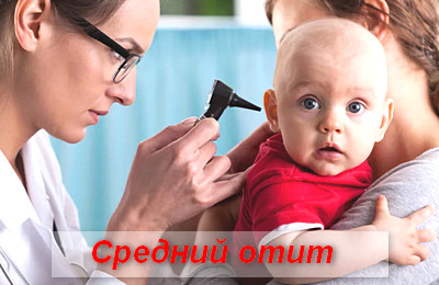средний отит