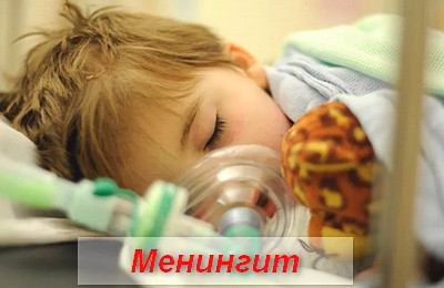 менингит