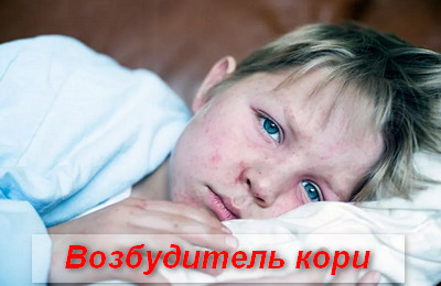 возбудитель кори