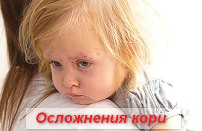 осложнения кори