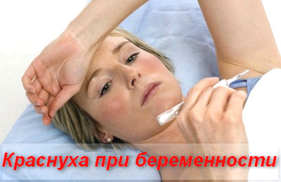 краснуха при беременности