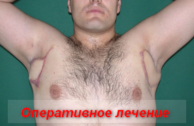 оперативное лечение