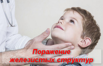 поражение железистых структур